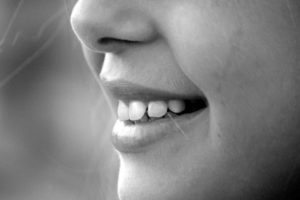 smile-mouth-teeth-laugh-65665-624x416-2-300x200